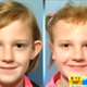 Illustration for article titled Seven-Year-Old Gets Plastic Surgery To Avoid Playground Bullying